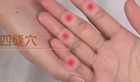 四缝穴