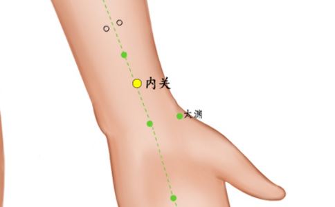 内关穴位的准确位置图 内关穴位的准确位置 内关穴准确位置图