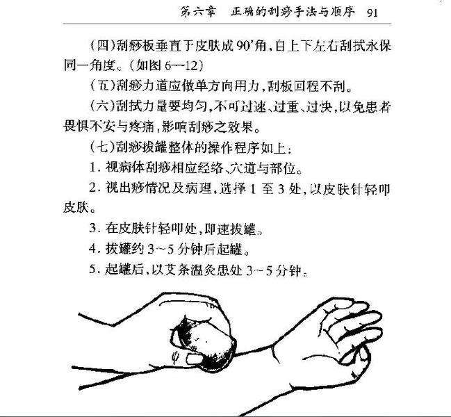 刮痧后注意事项