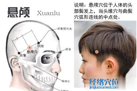 悬颅穴的位置图