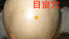按摩目窗穴缓解治疗远视、近视
