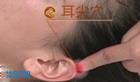耳尖穴清热祛风；缓解目赤肿痛、急性结膜炎
