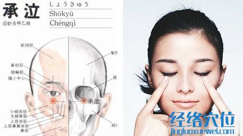 承泣穴的准确位置图