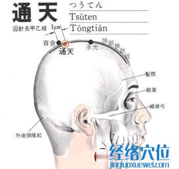 通天穴位位置图