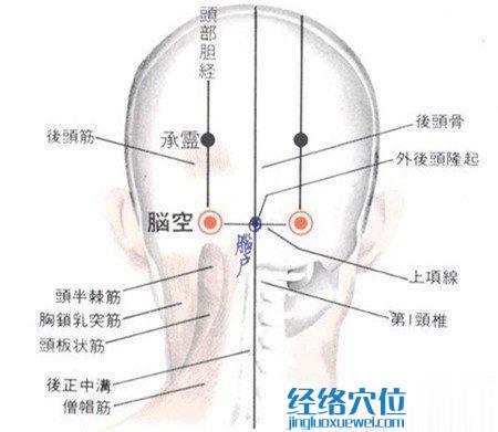 脑空穴的位置解剖分析图