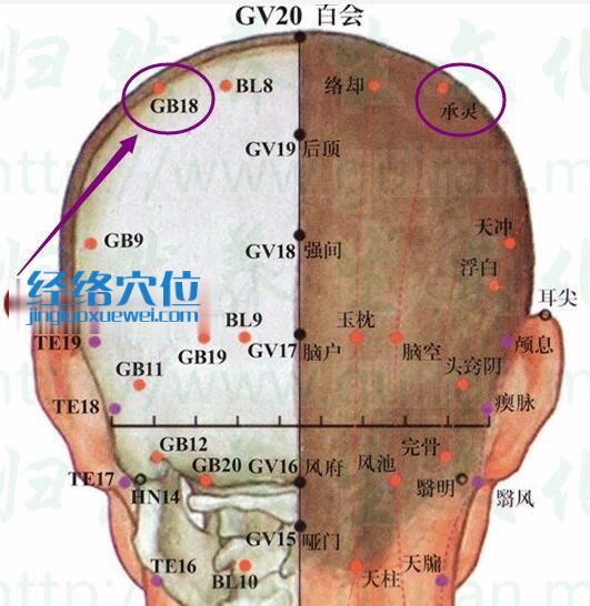 承灵穴的准确位置图