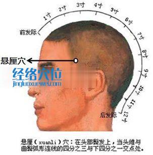 悬厘穴的位置图