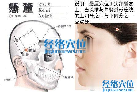 悬厘穴的位置解剖分析图