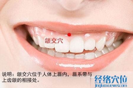 龈交穴