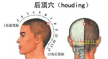 后顶穴的准确位置图