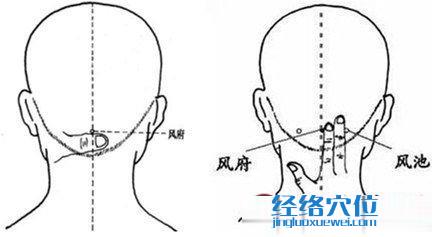 风府穴的取穴方法示范图