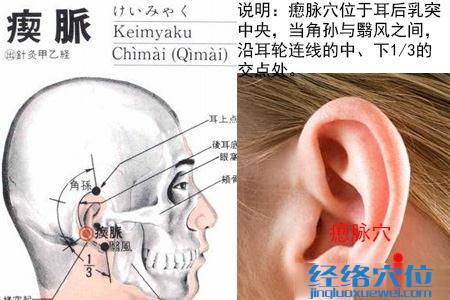 瘈脉穴的位置解剖分析图