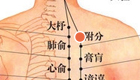 按摩附分穴位治疗颈项强痛、肩背拘紧