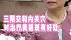 治疗黄褐斑