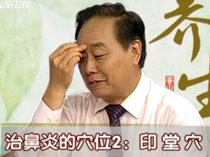 印堂穴的准确位置图