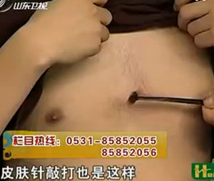 治疗心绞痛的穴位：膻中穴